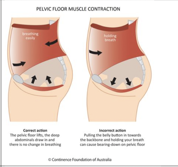 pelvic_floor-adelaide-osteopath-resilient-health-chiropractor-massage-osteopathy