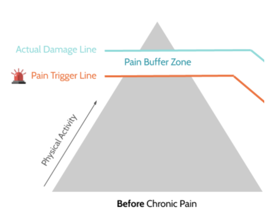 acute pain diagram resilient health acute pain