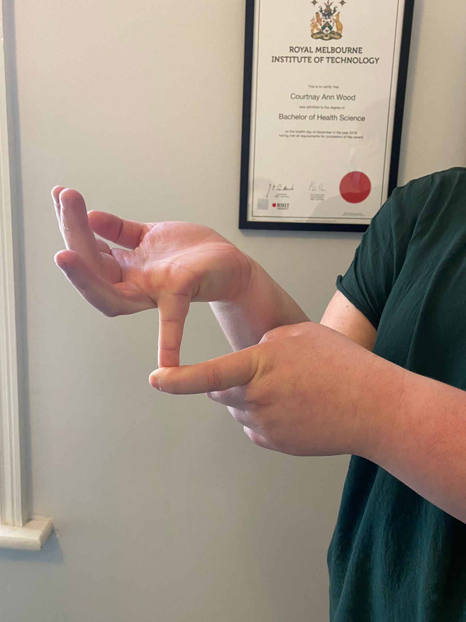 Beighton score hyper mobility resilient health osteopath chiropractor